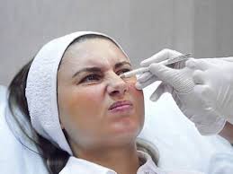 лечение морщин носа
